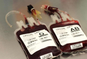 Patients who receive blood transfusions from young, female donors `are more likely to die`